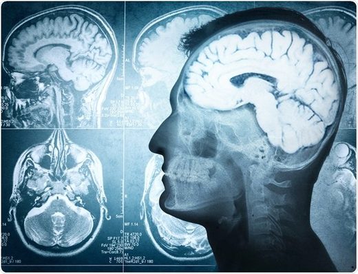 New Study: Human brain stays alive for hours after death New Study: Human brain stays alive for hours after death