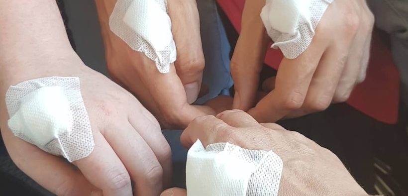 microchipped hands