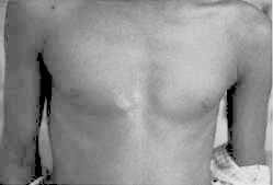 Click to enlarge Birth defects (Figure 1)