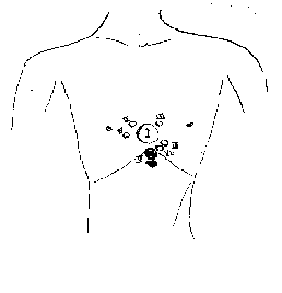 Click to enlarge Birth defects (Figure 2)