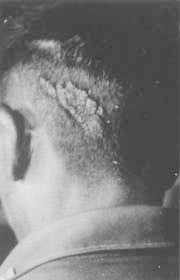 Click to enlarge Birth marks (Figure 3)