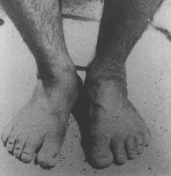 Click to enlarge Birth defects (Figure 4)