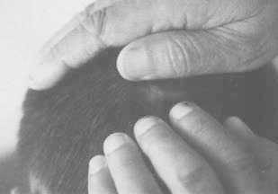 Click to enlarge Birth defects (Figure 5)