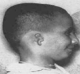 Click to enlarge Birth defects (Figure 8)
