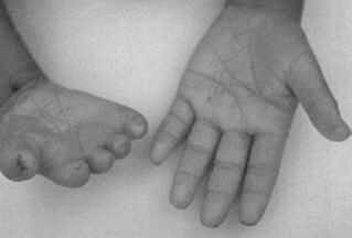 Click to enlarge Birth defects (Figure 9)