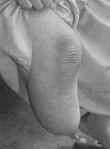Click to enlarge Birth defects (Figure 10)