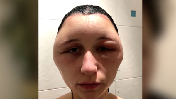Woman's reaction to hair dye