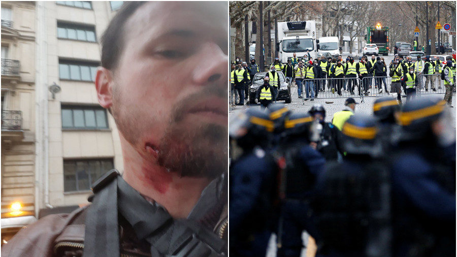 Reporter shot in face
