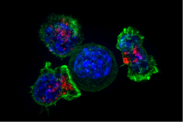 Killer T cells surround cancer cell