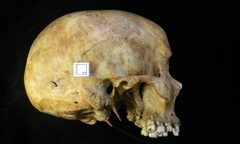 skeleton covent garden dig stab wound