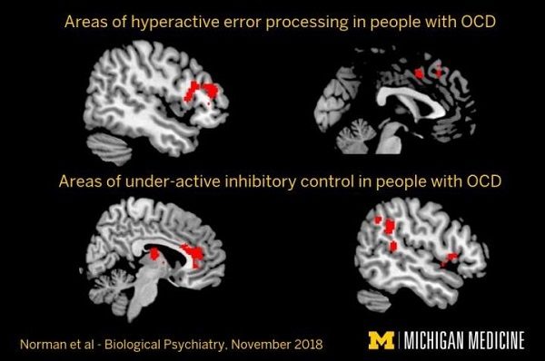 Click to enlarge Brain scans