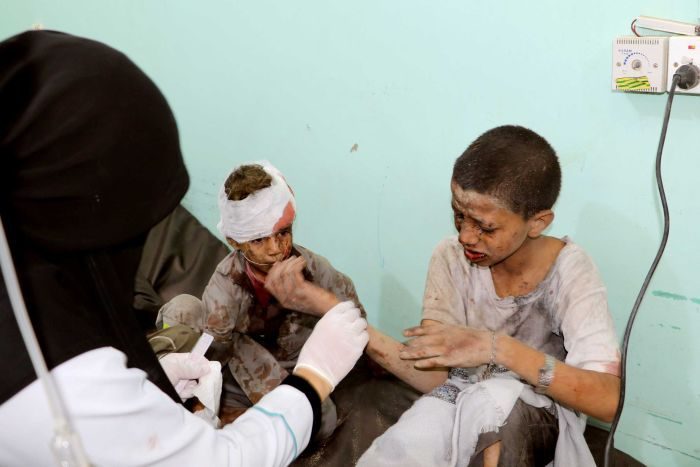 Yemeni children war