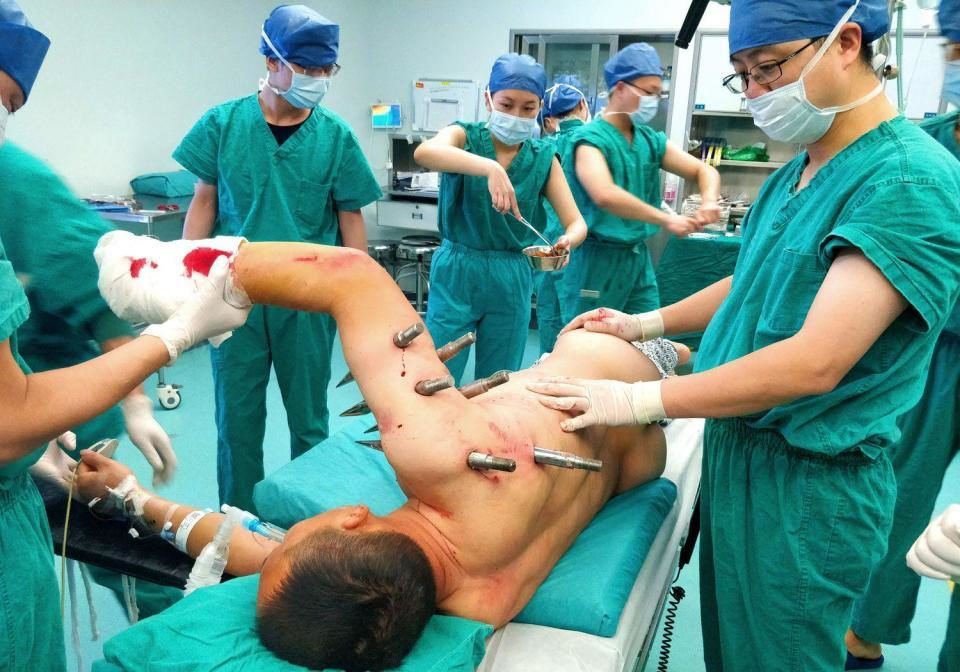Click to enlarge Surgeons working to remove the skewers