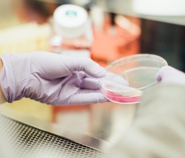 Toxins in petri dish