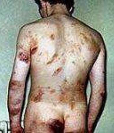 Irish citizen tortured