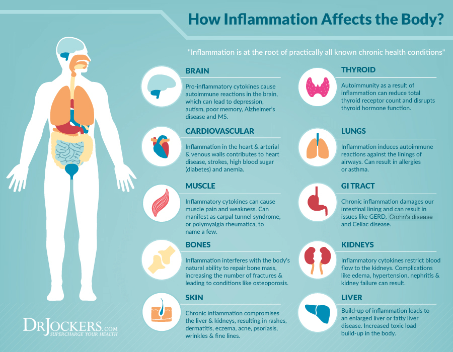 inflammation