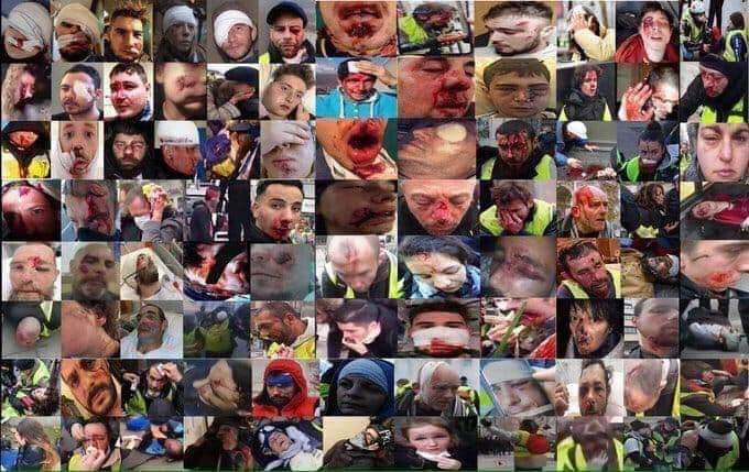 Blessures Gilets jaunes