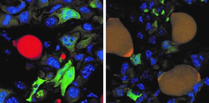 Click to enlarge cancer cells to fat