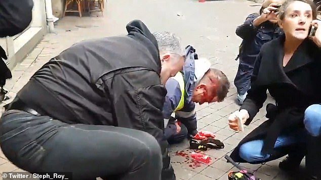 Click to enlarge yellow vest shot in head