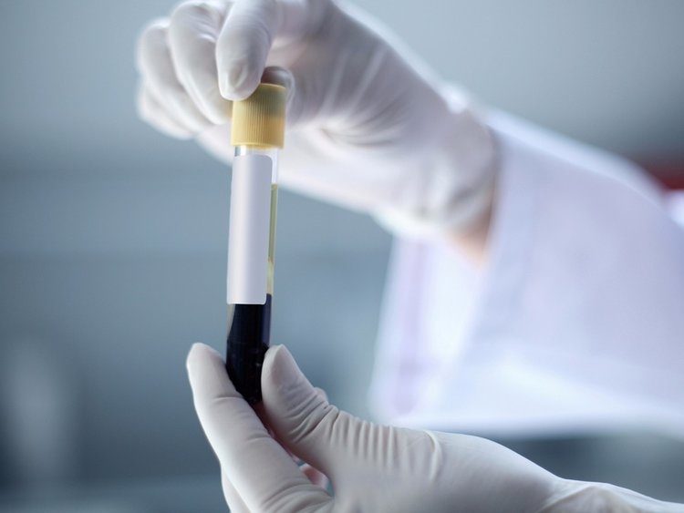 Click to enlarge vial of blood