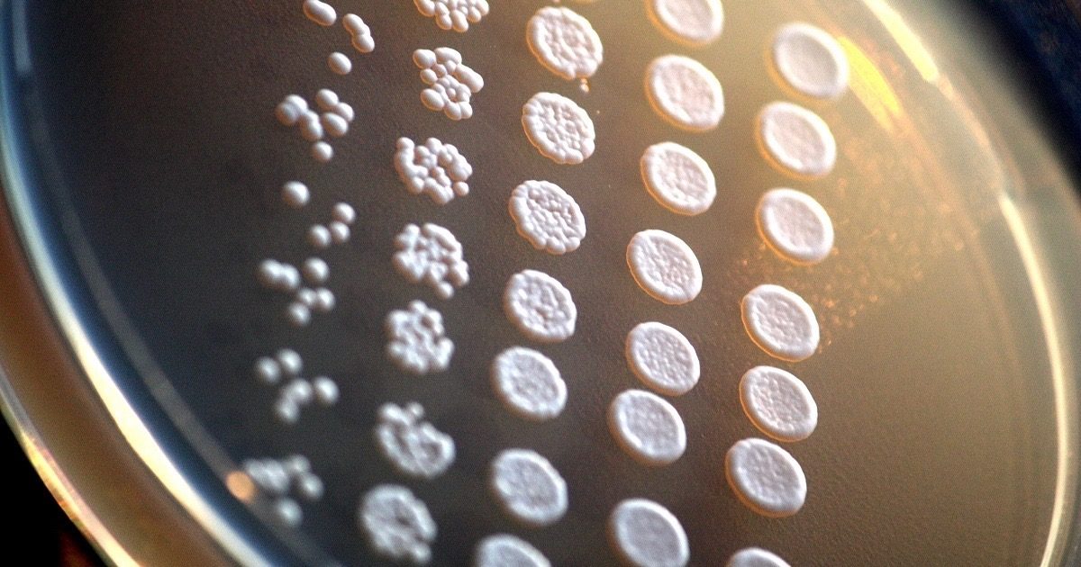 Click to enlarge Saccharomyces cerevisiae