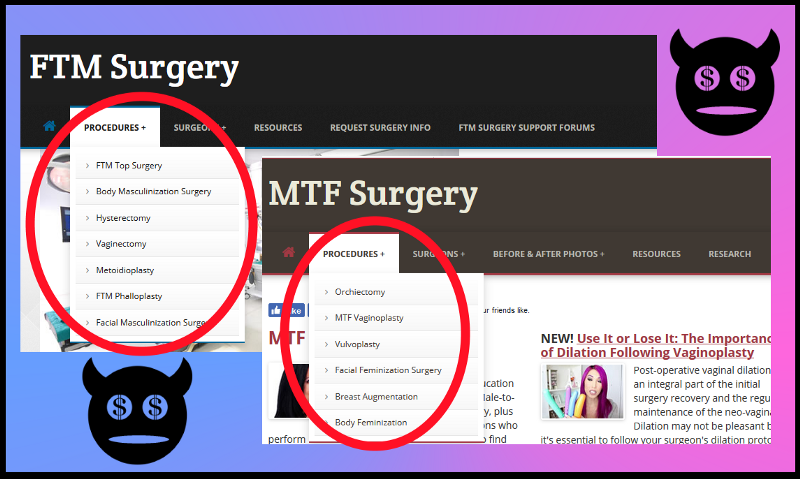 Click to enlarge Transgender FTM MTF surgery
