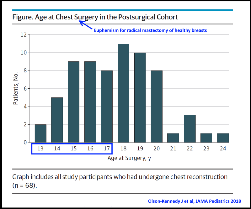 Click to enlarge Radical mastectomy healthy breasts