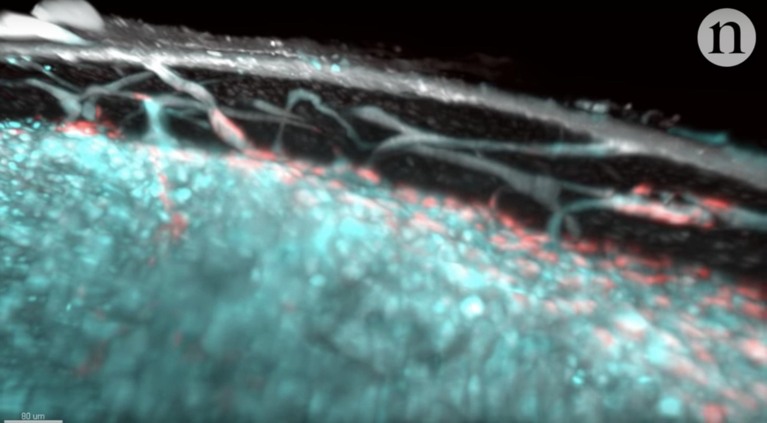 Capillaries in Bones