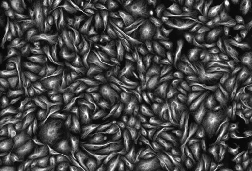 Click to enlarge Microtubules
