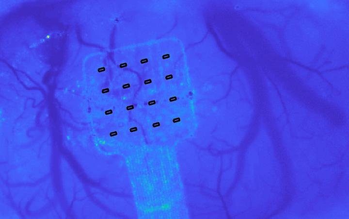 Graphene based sensor