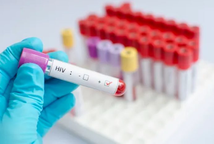 HIV sample