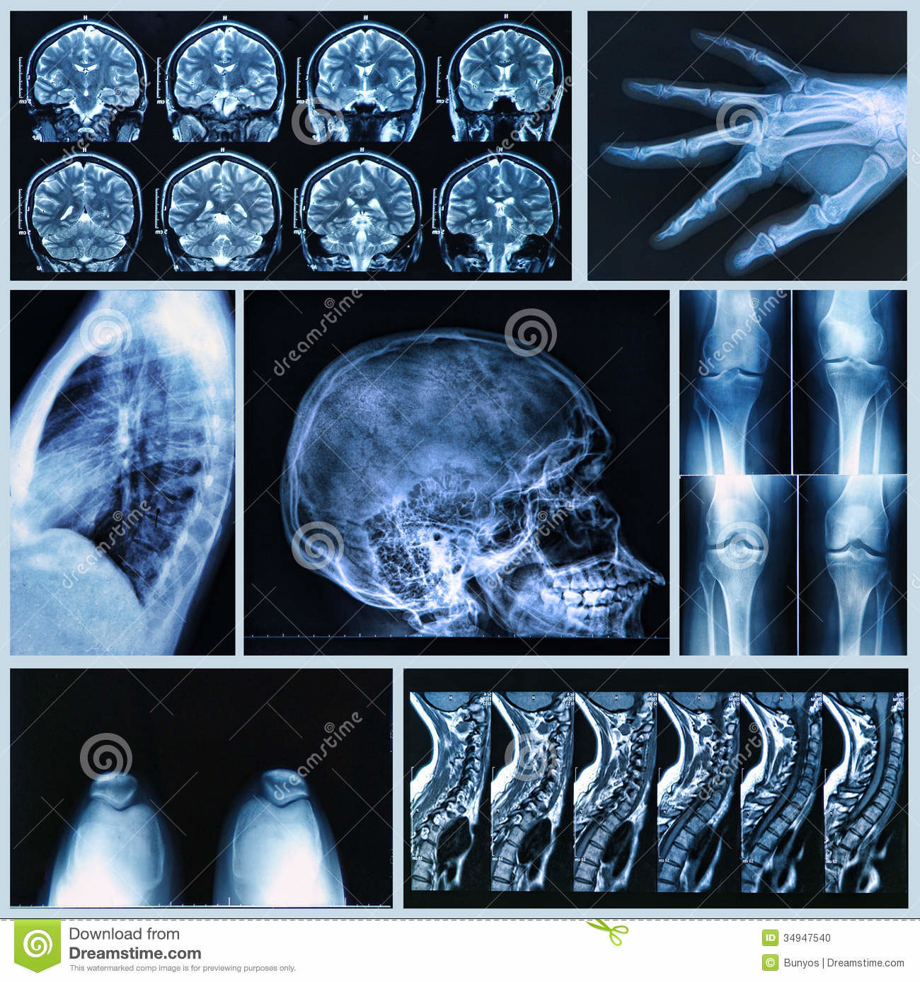 Click to enlarge X Ray Images