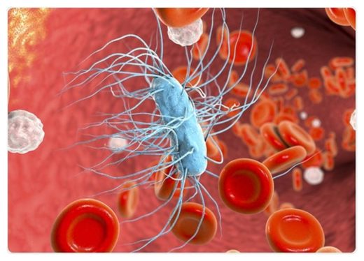 Click to enlarge Sepsis Prevention