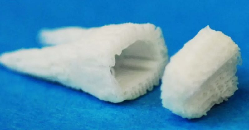 stem cell dental implants