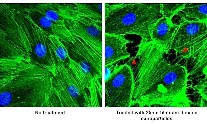 Click to enlarge Blood vessels/treated