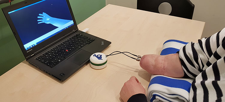 Click to enlarge Hand prosthesis being tested