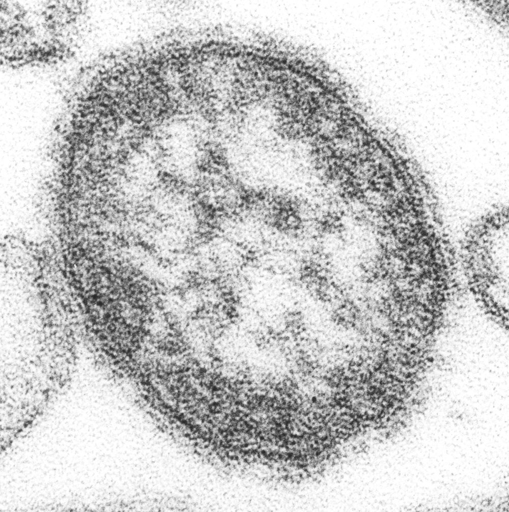 Click to enlarge Measles virus