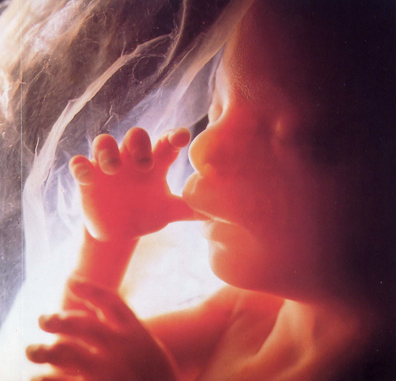 fetus