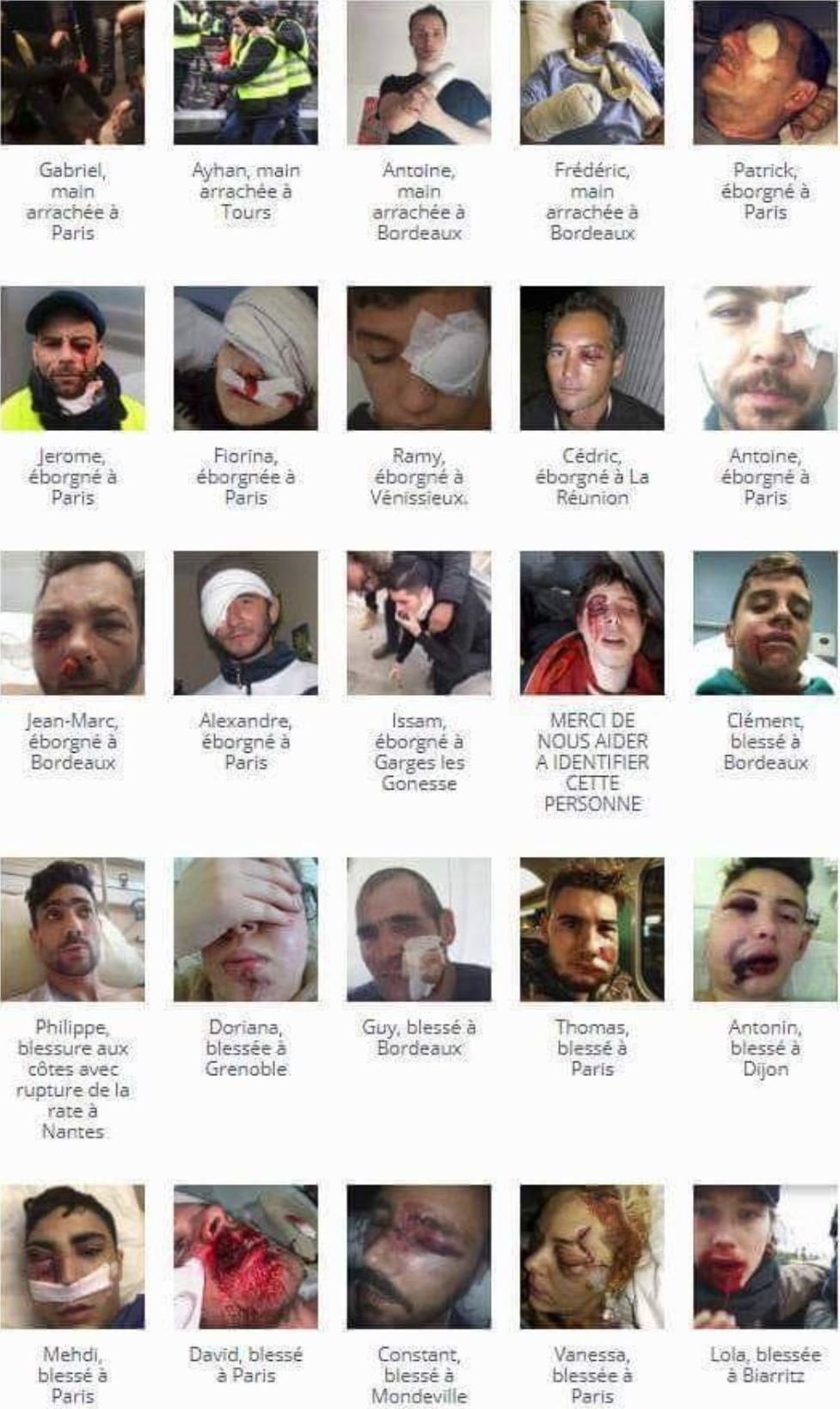Gilets jaunes blessés