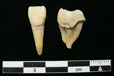 Click to enlarge plaque teeth milk