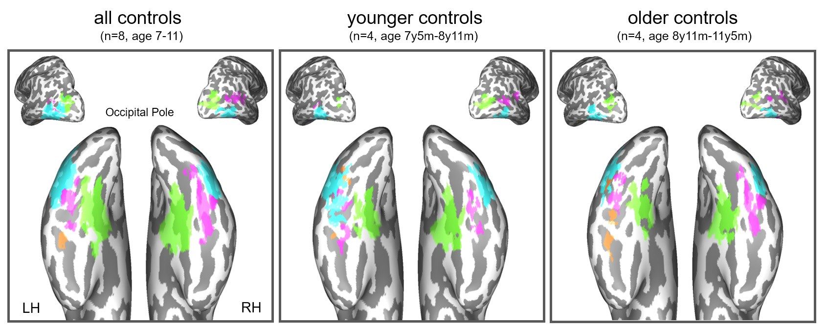 Click to enlarge brain scans