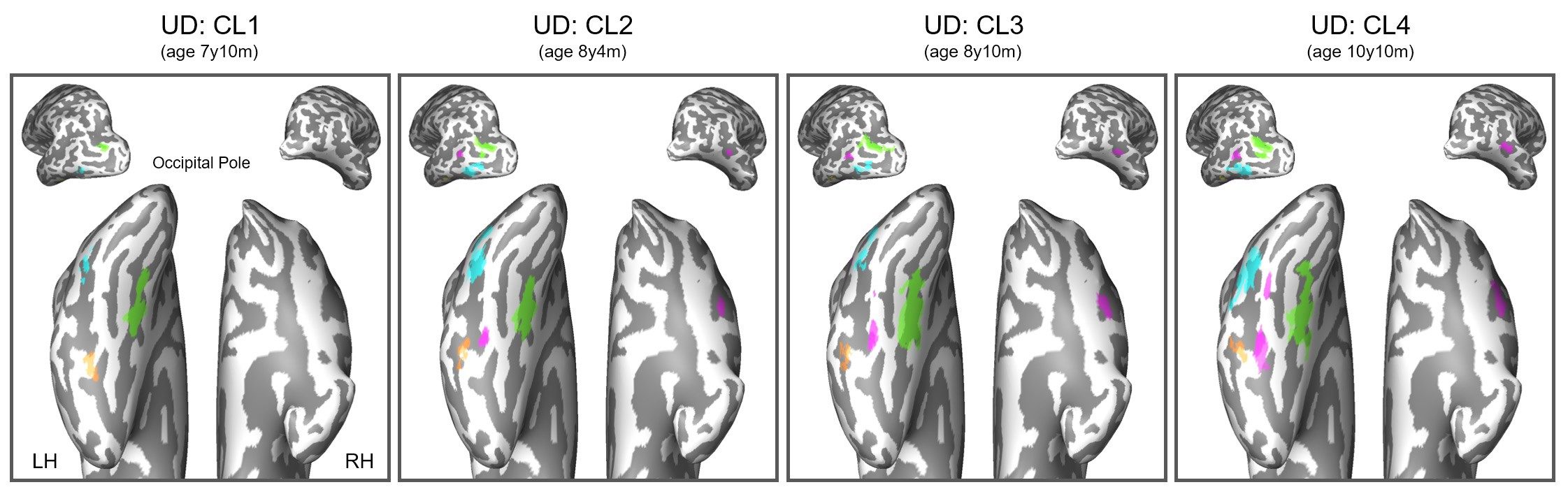 Click to enlarge brain scans