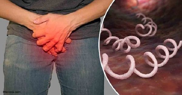Click to enlarge syphilis