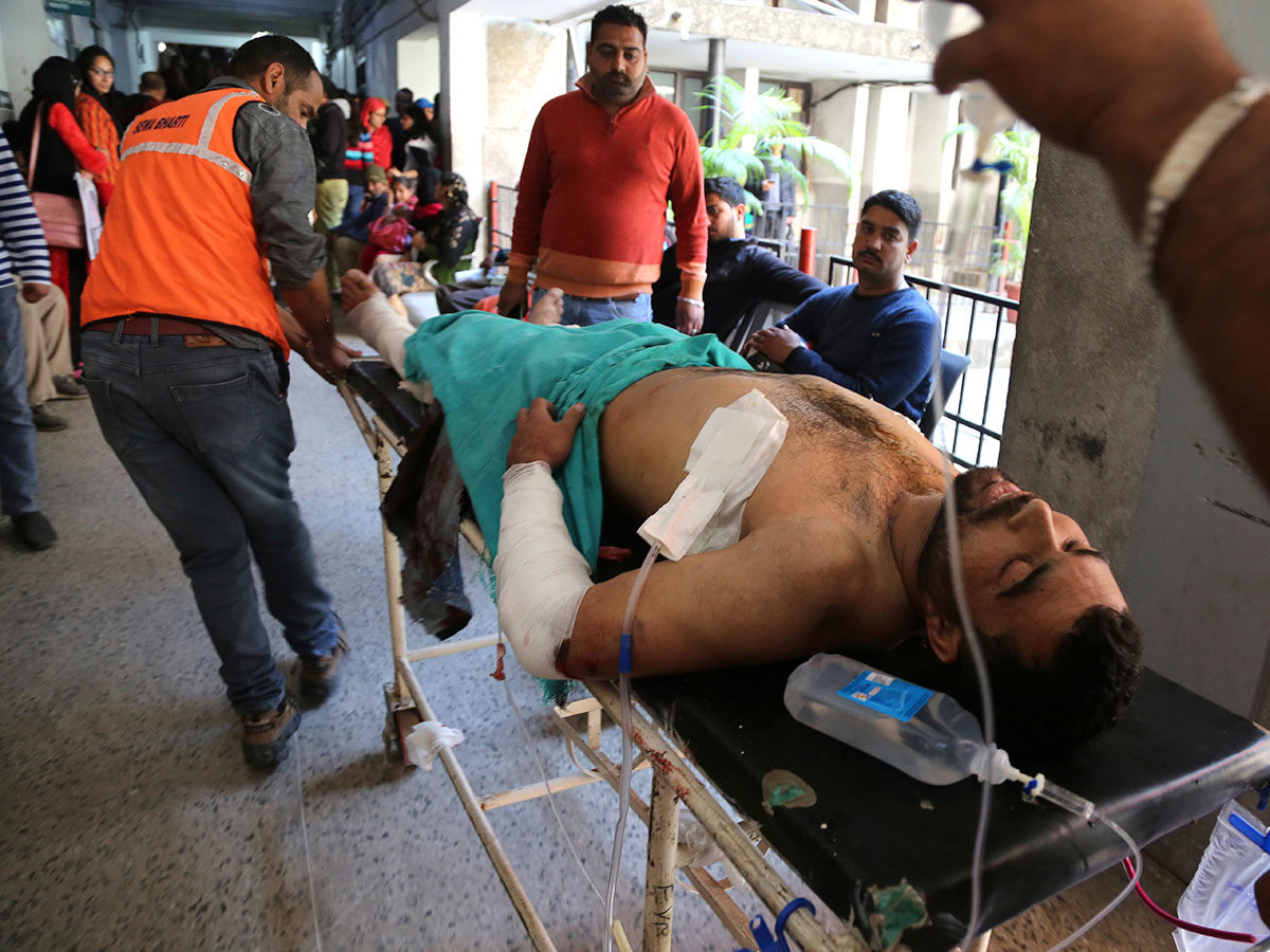 Click to enlarge person injured Jammu, India