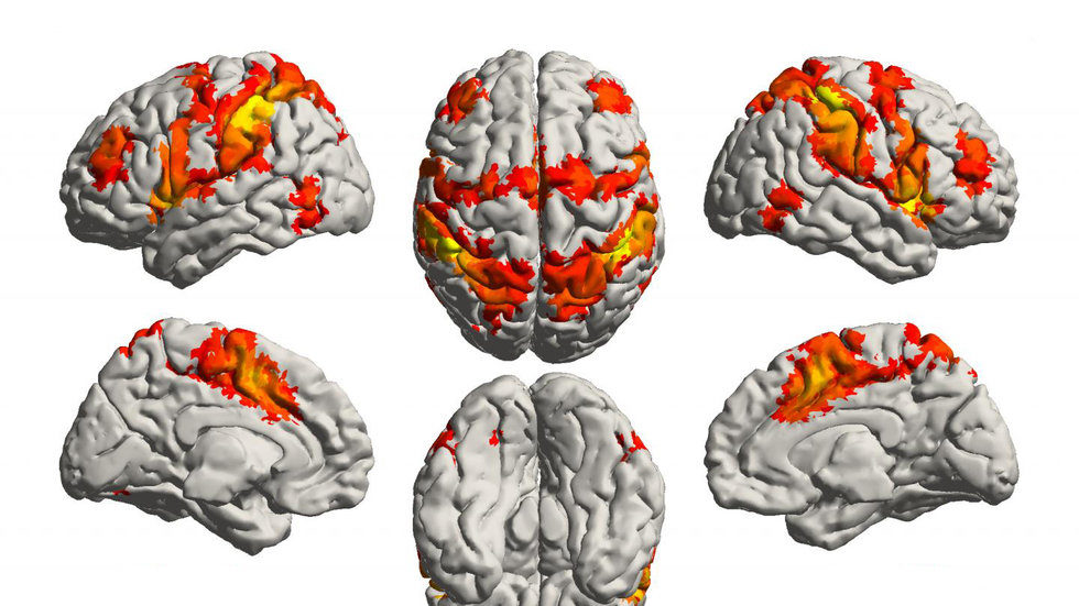 brain regions