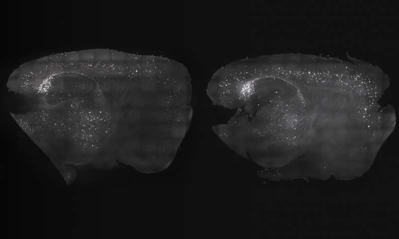 Click to enlarge mice brainwave stimulation alzheimer's