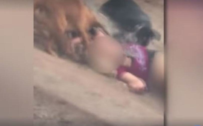 dog attack