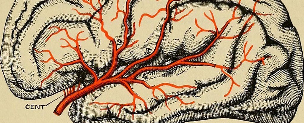 Click to enlarge brain