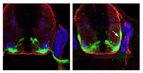 Click to enlarge Motor neurons