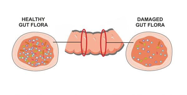 Click to enlarge gut bacteria